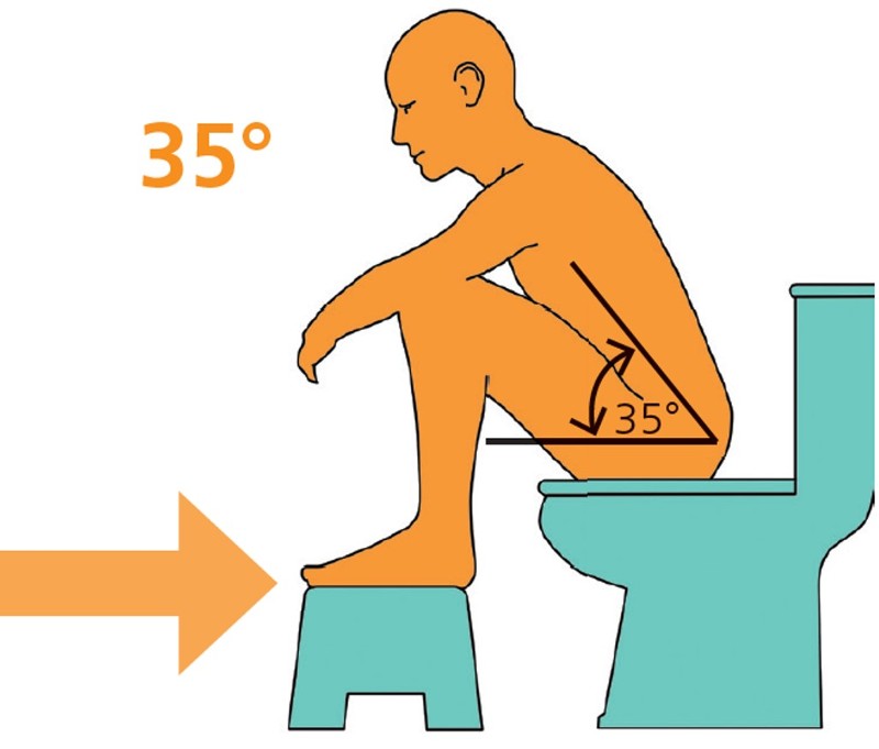 Abbildung eines Mannes der mit angewinkelten Beinen auf der Toilette sitzt