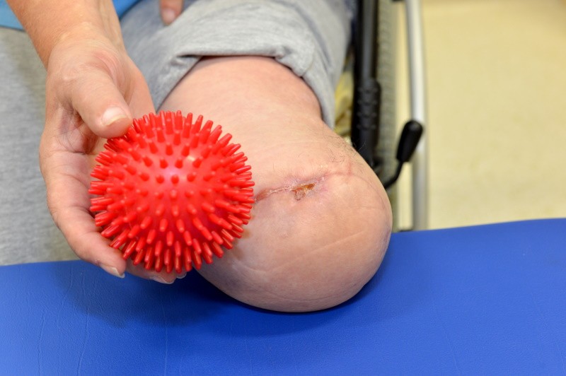 Ein Igelball wird über den Amputationsstumpf zur Stumpfabhärtung gerollt.
