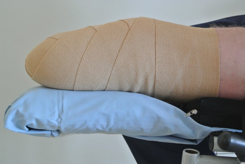 Ein bandagierter Unterschenkelstumpf wird auf einem gepolsterten Brett, welches auf dem Rollstuhl aufliegt, gelagert.