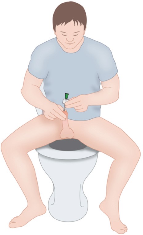 Mann beim Selbstkatheterisieren sitzend auf der Toilette