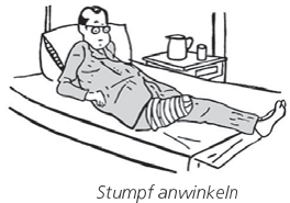Patient liegt mit angewinkelten Stumpf auf dem Bett.